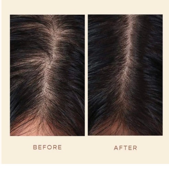 Vegamour GRO Hair Serum - Picture 9 of 10